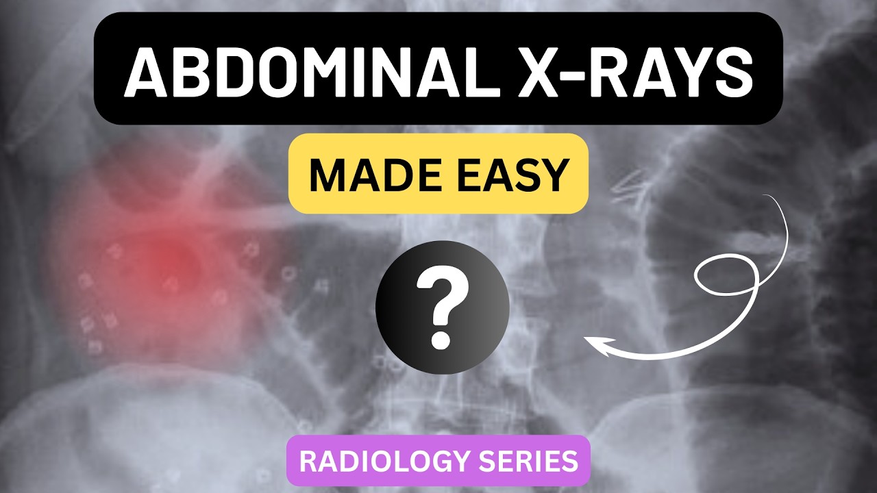 How to Read an Abdominal X-ray (AXR) | Systematic Approach