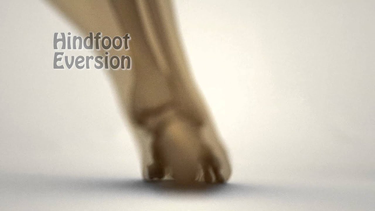Demonstration of Forefoot influence on Proximal Kinematics Valgus vs Varus