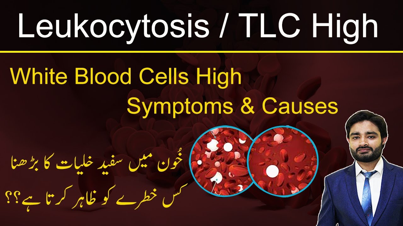 Leukocytosis/TLC High | White blood cells high symptoms & causes | خون میں وائٹ سیلز کیوں بڑھتے ہیں