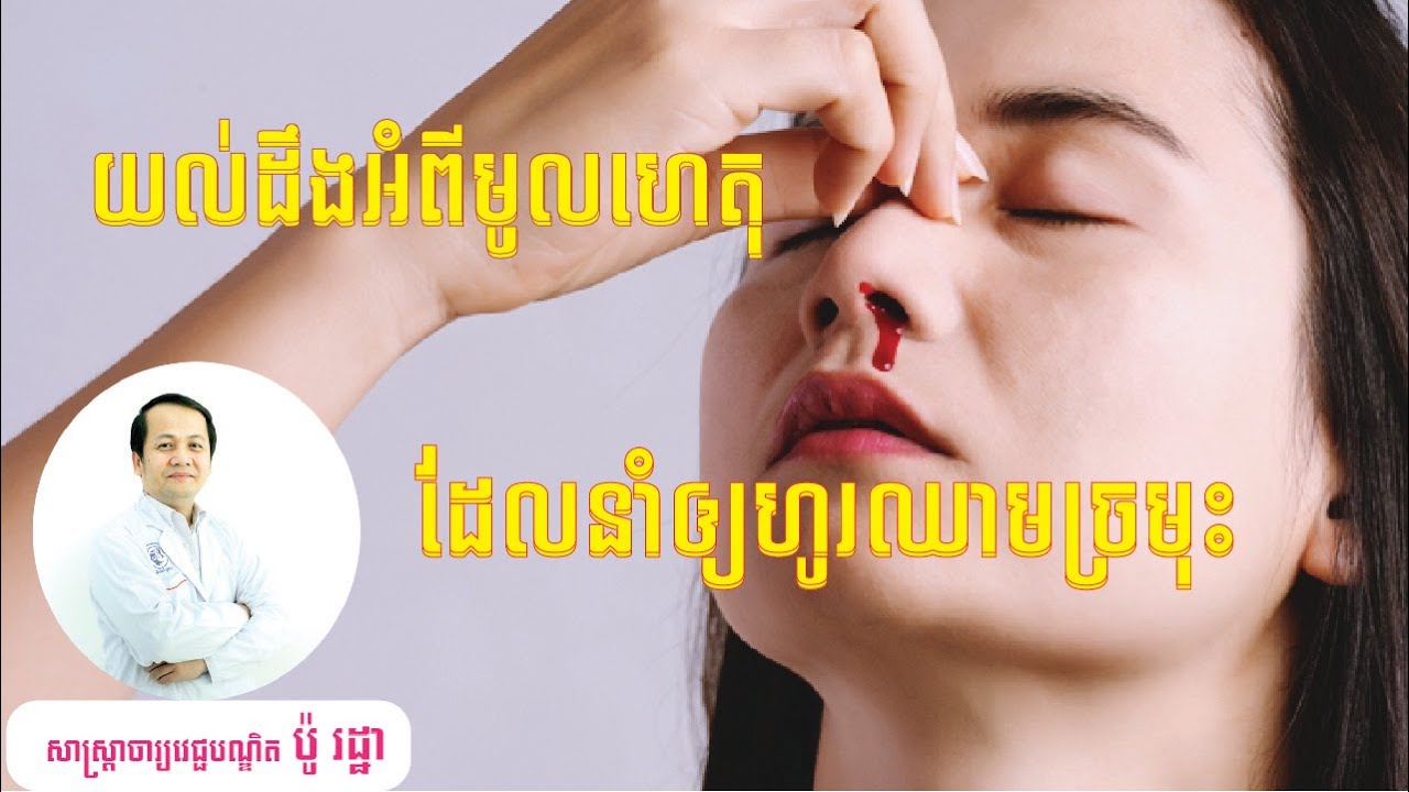 យល់ដឹងអំពីមូលហេតុដែលនាំឲ្យហូរឈាមច្រមុះ