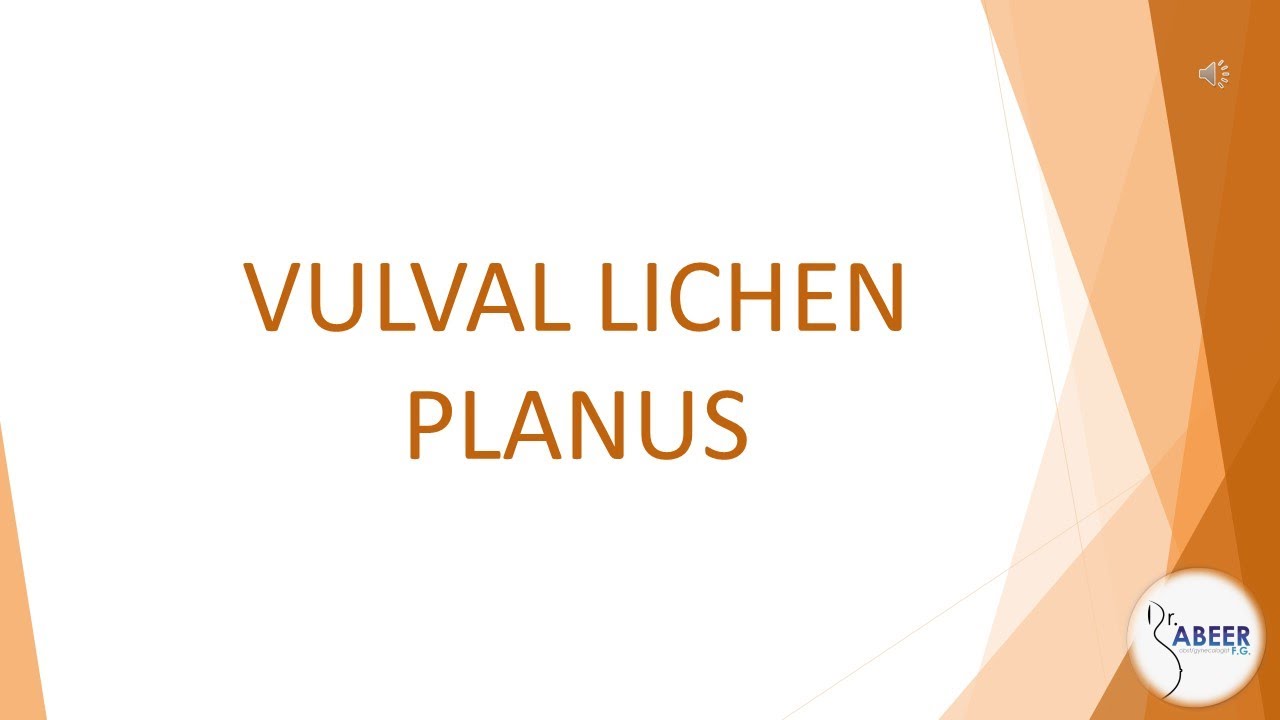 Advanced ObsGyne Lecture  2014 UK National Guideline on the Management of Vulval Conditions Part 2