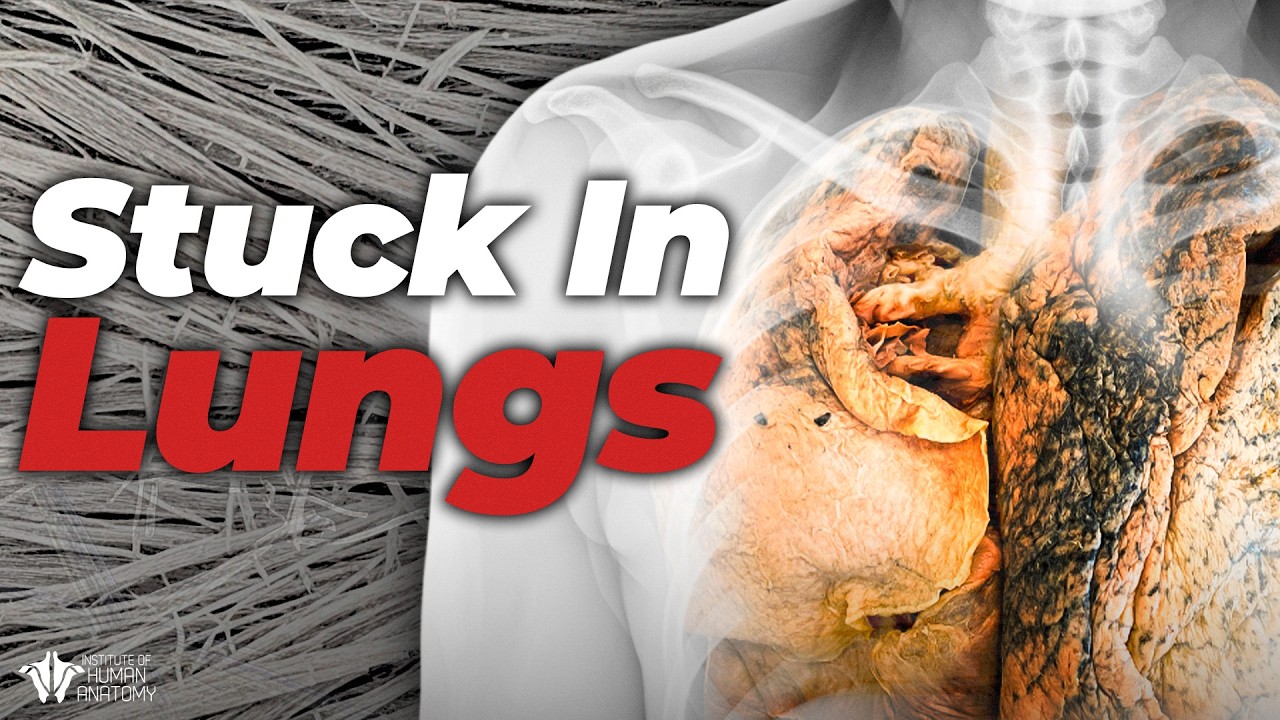 What Asbestos Actually Does to the Human Body