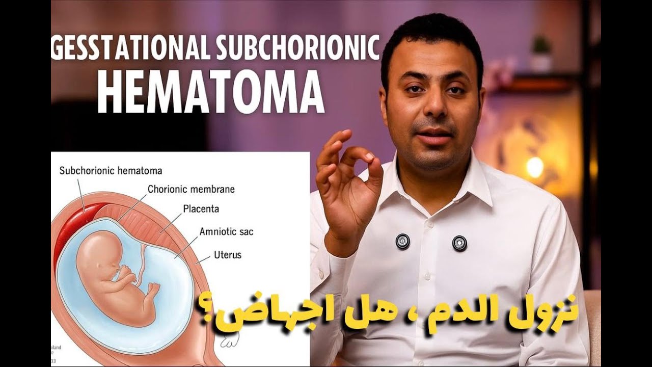 نزول الدم في الحمل (النزيف) - هل اجهاض؟؟ - والحل؟
