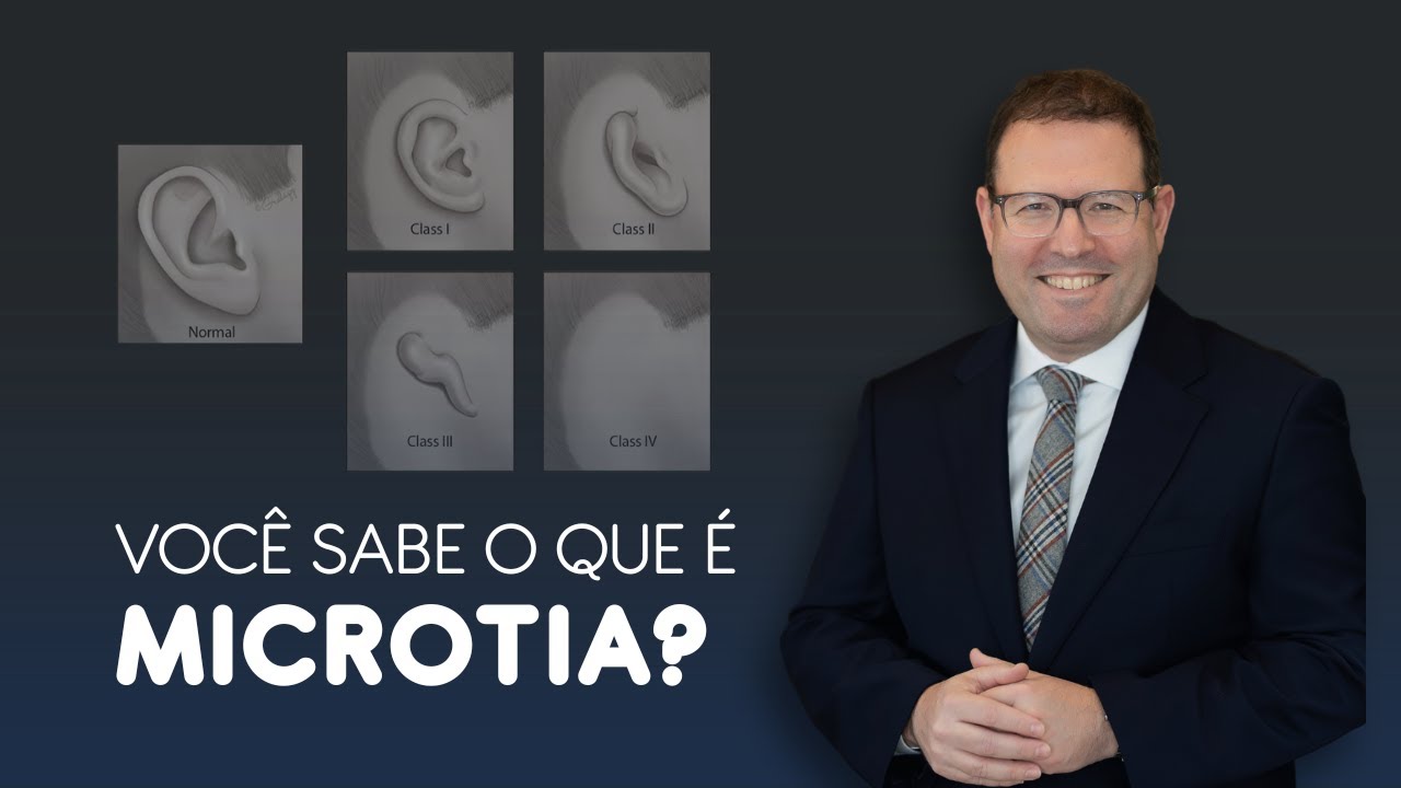 Você sabe o que é microtia?