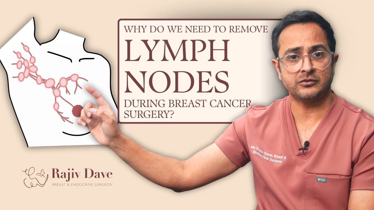 Why Do We Remove Lymph Nodes During Breast Cancer Surgery?