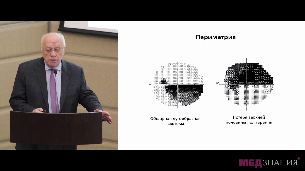 11 Глаукома с псевдонормальным давлением