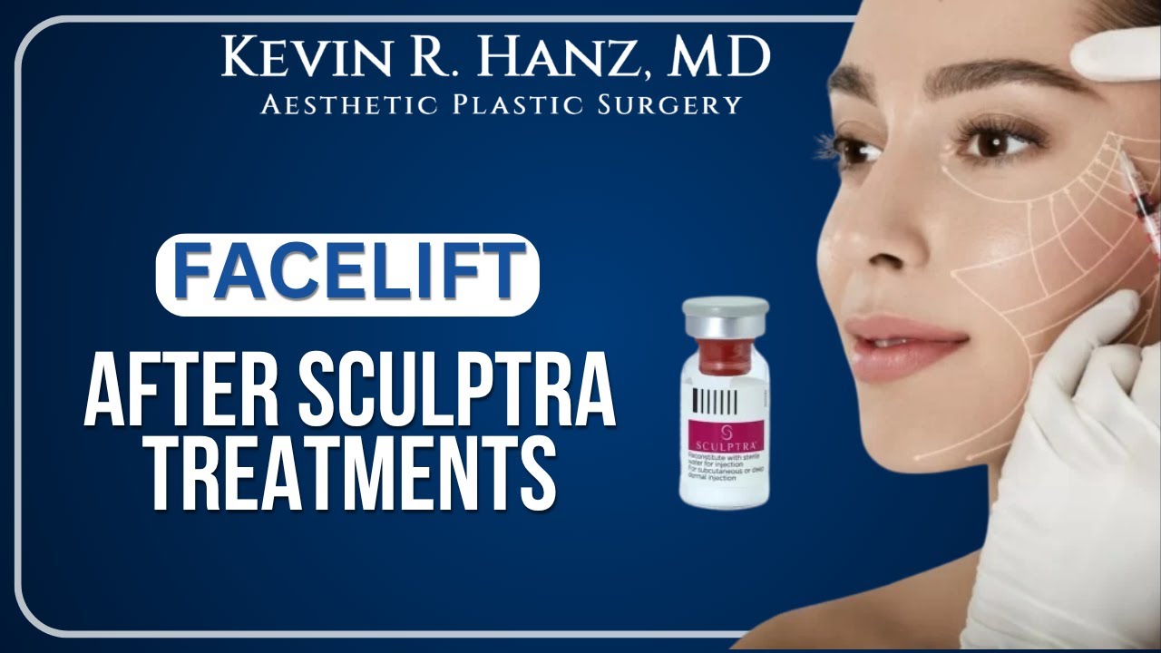 Does #sculptra negatively impact a future #facelift 👀 | Dr. Kevin Hanz, Dallas Plastic Surgeon.