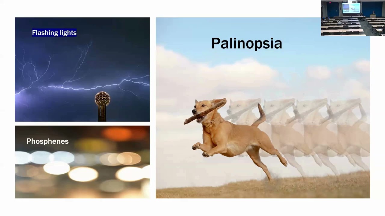 Symptomatic treatment in NMOSD, MOGAD, & TM