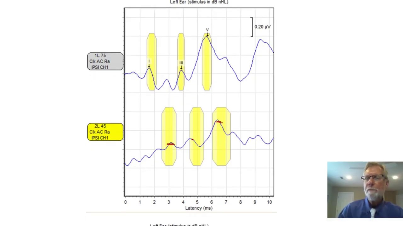 VivoSonic Integrity Gen 2