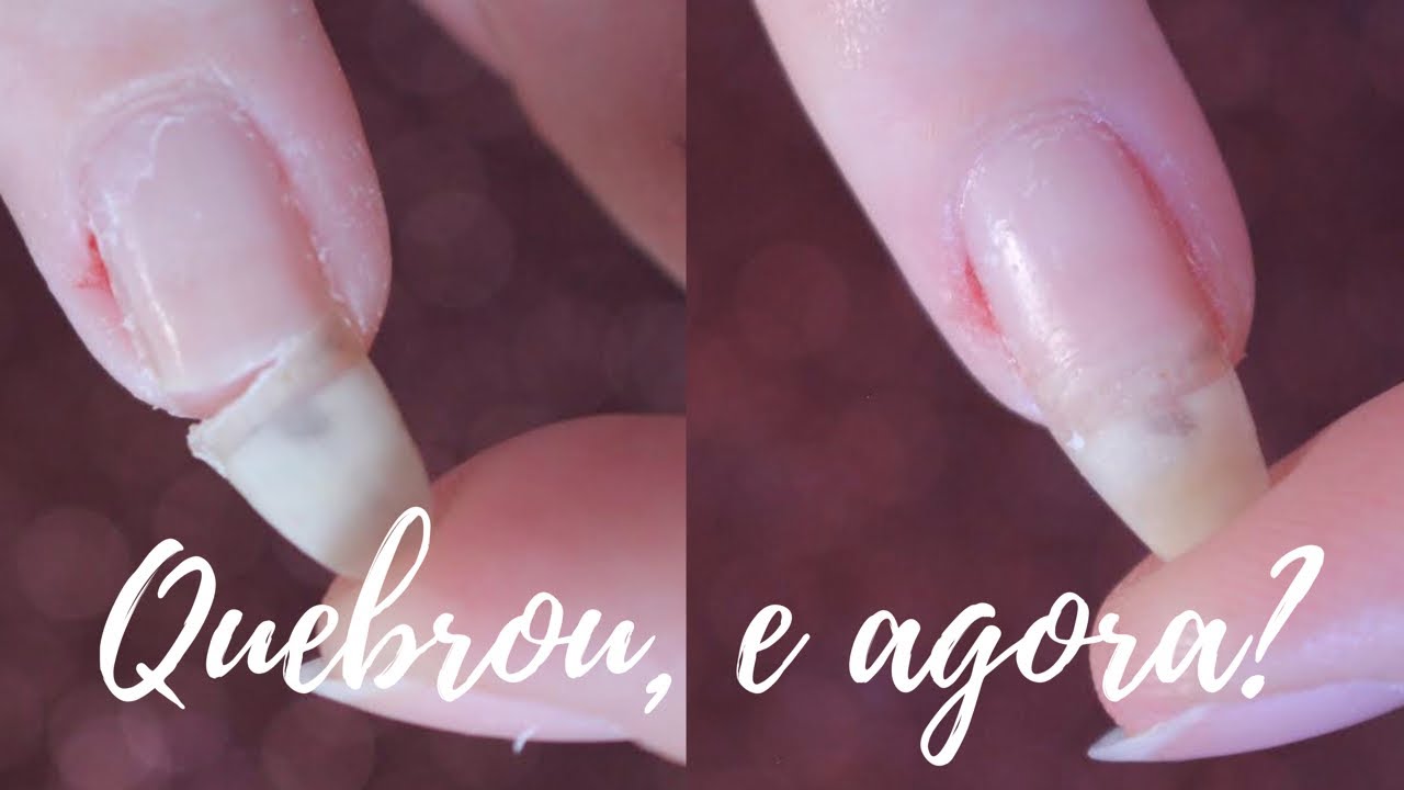 COMO COLAR UNHA QUEBRADA COM PAPEL HIGIÊNICO | EX ROEDORA DE UNHAS