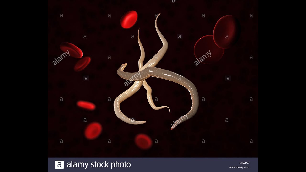 Nématodes transcutanés anguillulose strongyloide stercoraris 3 eme année médecine résumé des cours