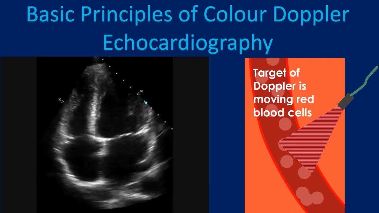 Basic Principles of Colour Doppler Echocardiography