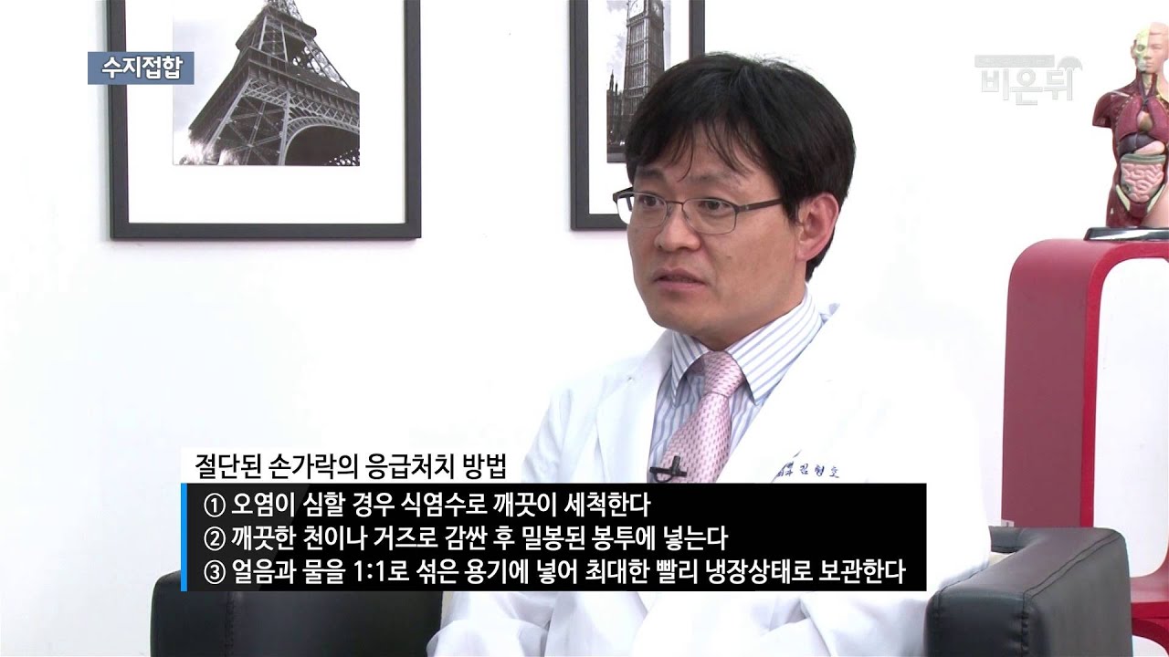 [기획취재] 손목터널증후군과 수부질환