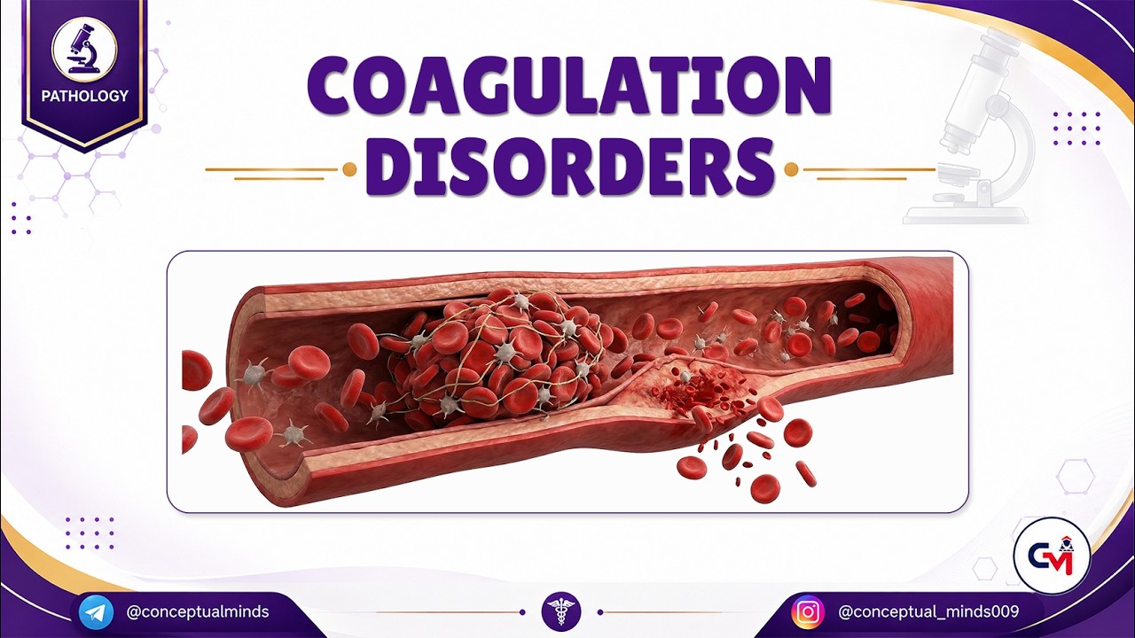 5. Coagulation Disorders 🩸Bleeding Disorders, Pathogenesis & Lab Correlation | High-Yield Pathology