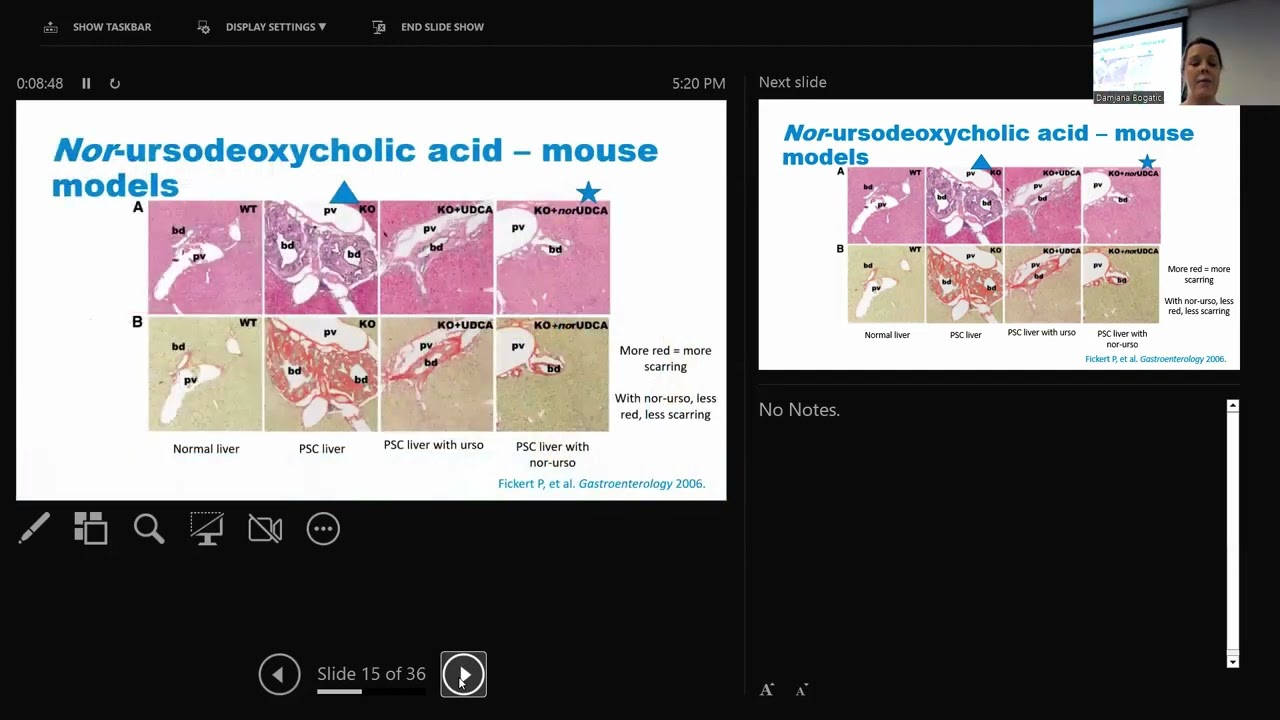 What's new in PSC: Therapies and Monitoring (Dr. Kate Lynch)