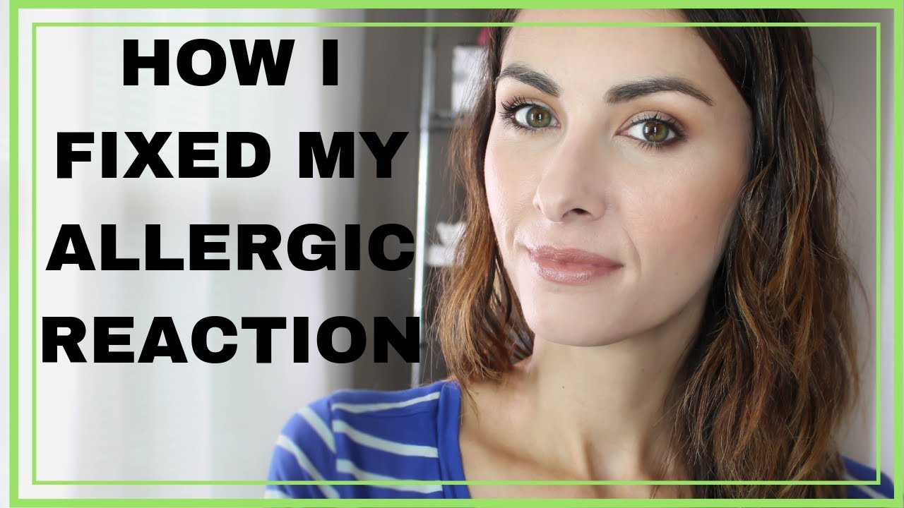 Perioral Dermatitis (Healing My Allergic Skin Reaction)