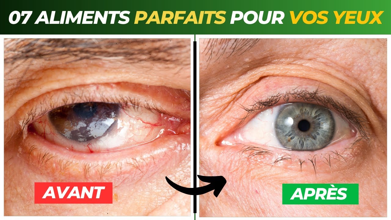 Comment Am&eacute;liorer votre Vue ? 7 Aliments Essentiels pour une vision parfaite | Sant&eacute; des yeux
