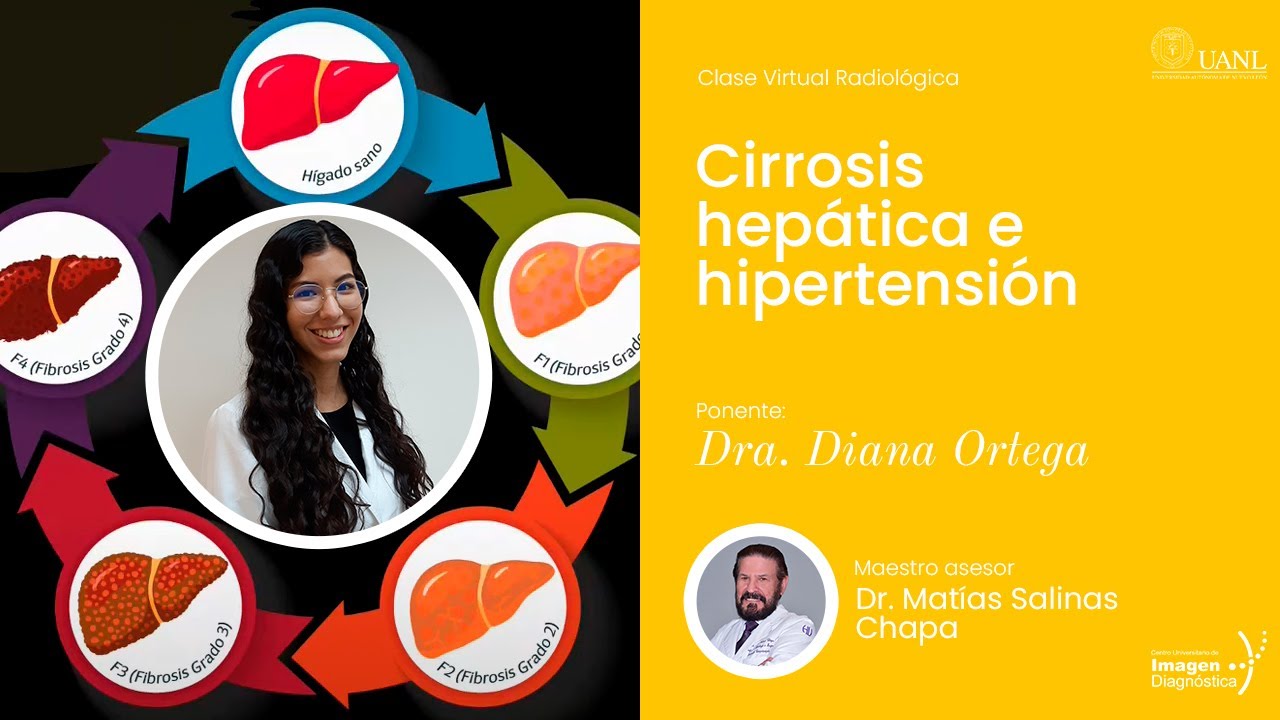 Cirrosis hepática e hipertensión portal por la Dra. Diana Ortega