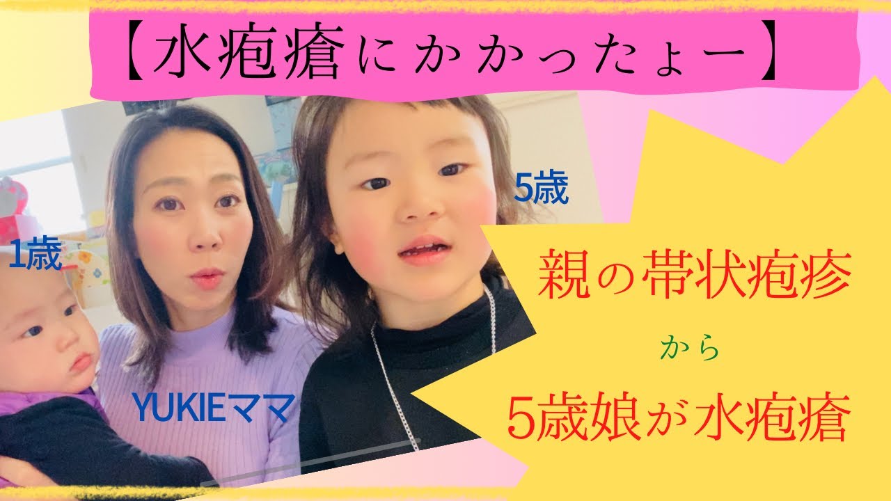 水疱瘡になったよ！5歳娘。帯状疱疹から移った模様。参考になれば嬉しいです。