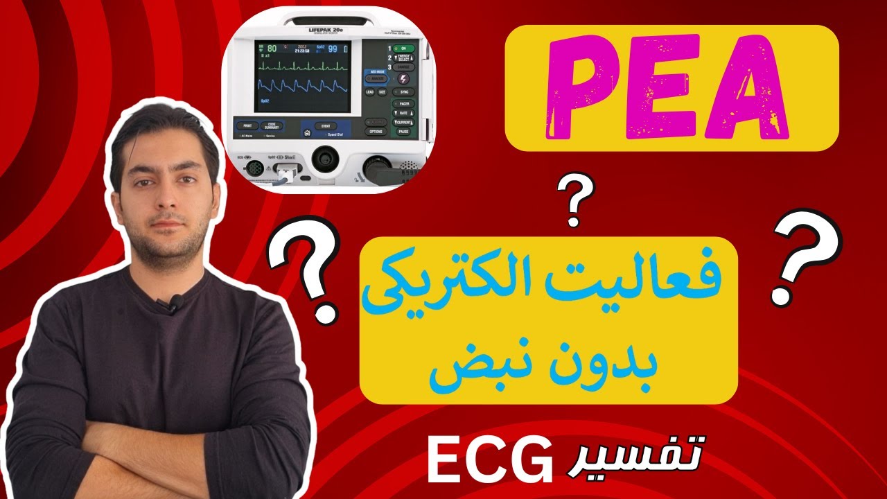 فعالیت الکتریکی بدون نبض قلب  PEA