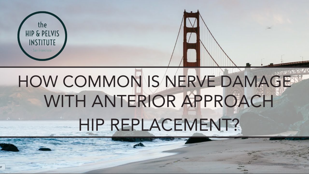 How Common Is Nerve Damage With Anterior Approach Hip Replacement?