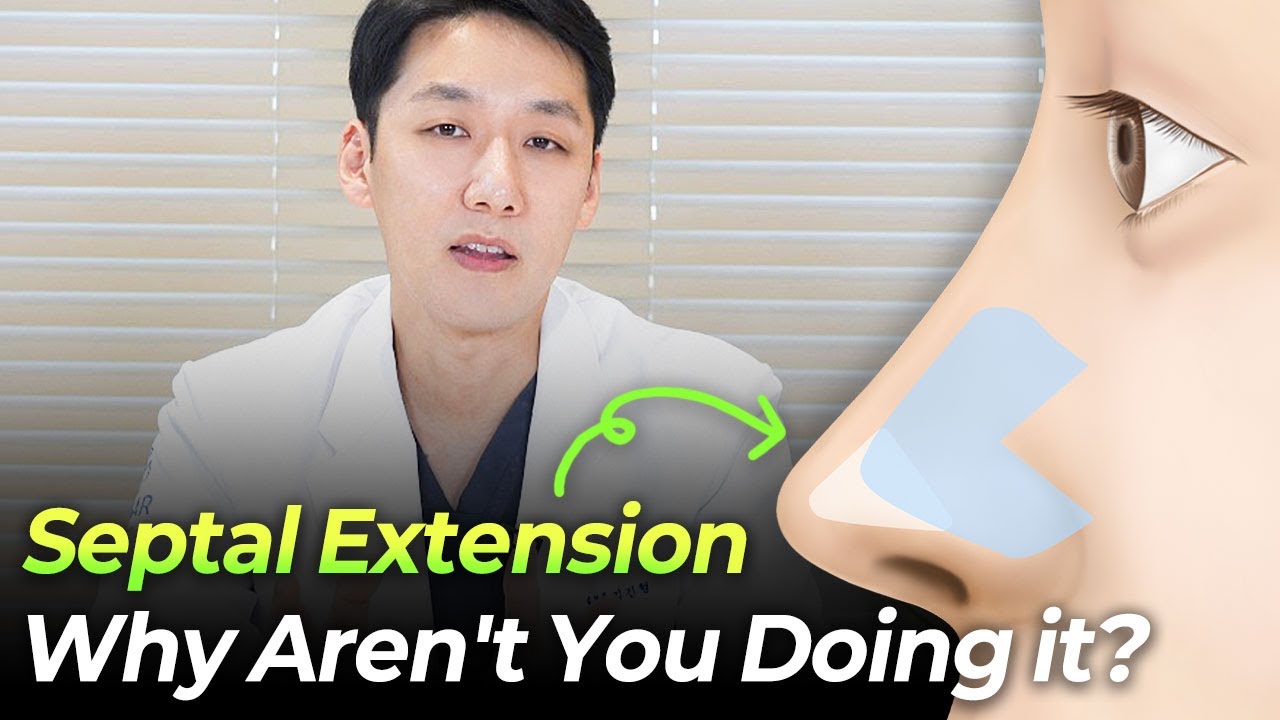 Septal Extension Secrets 🤫 Just Between Us! #rhinoplasty