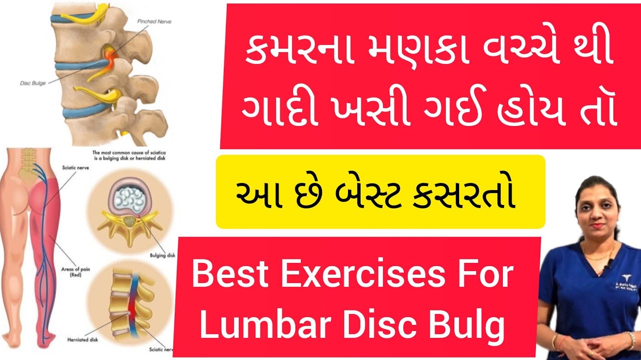 કમરમાં મણકા વચ્ચેથી ગાદી ખસી ગઈ હોય એના માટેની અસરકારક કસરતો | Exercises For Lumbar Disc Bulg