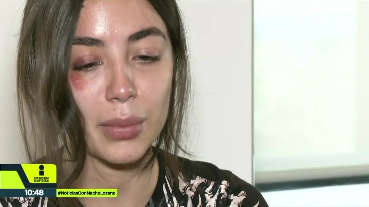Daniela Toussaint fue agredida por la policía en la marcha de la G-Z | Noticias con Nacho Lozano