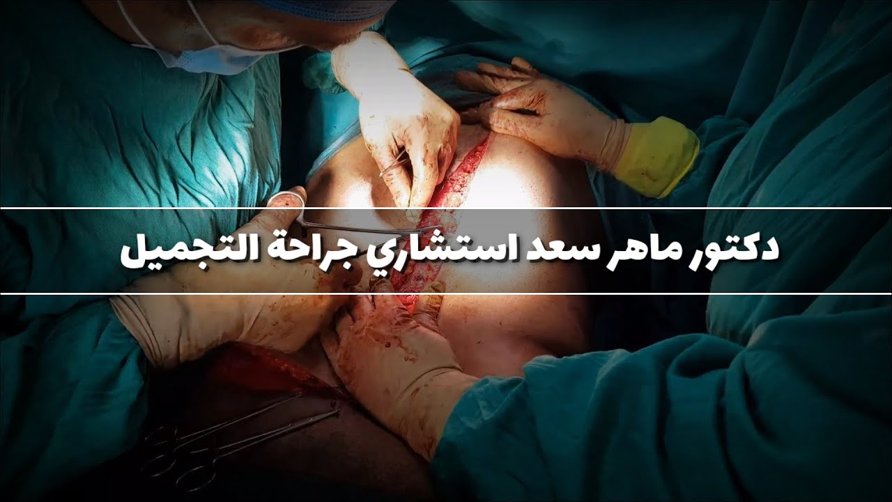 افضل جراح تجميل فى مصر / دكتور ماهر سعد