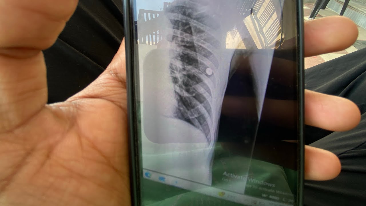 X Ray Me Ye Kya Chij H 😱