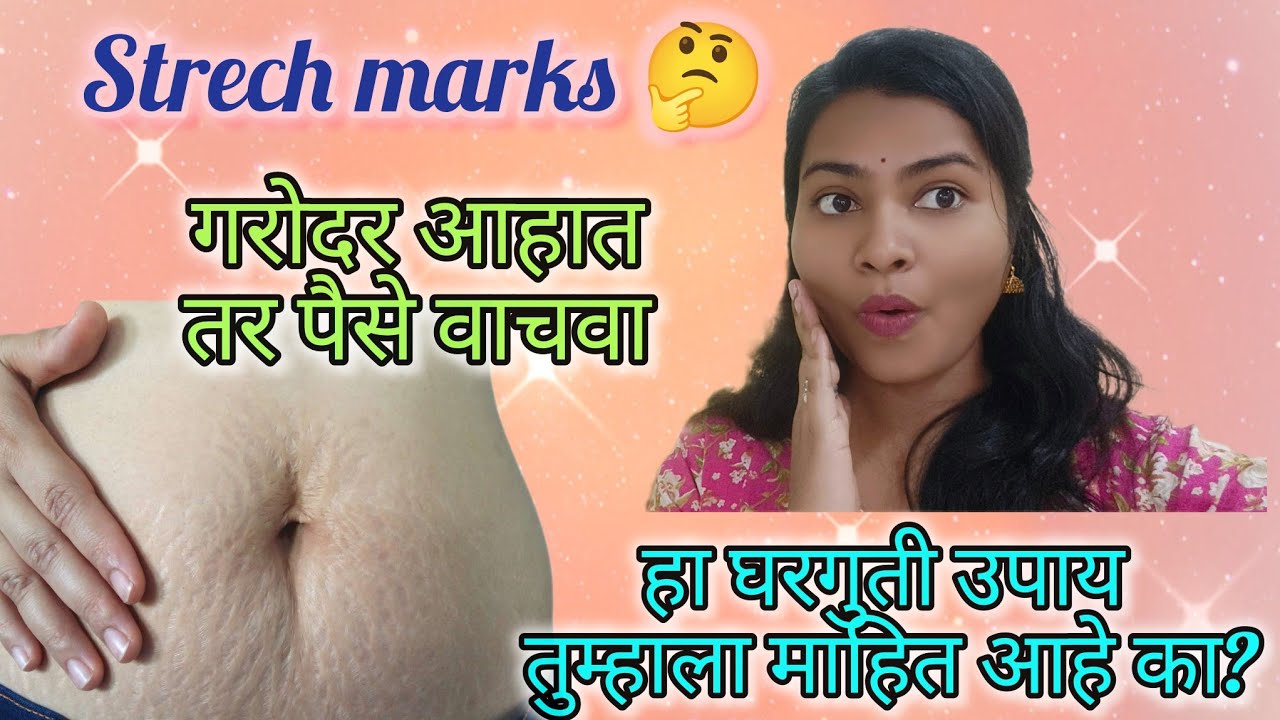 👉 घरगुती उपायांनी Stretch Marks कसे कमी करावे🔥? | Marathi Home Remedies🫄#viral  #pregnancy #marathi 