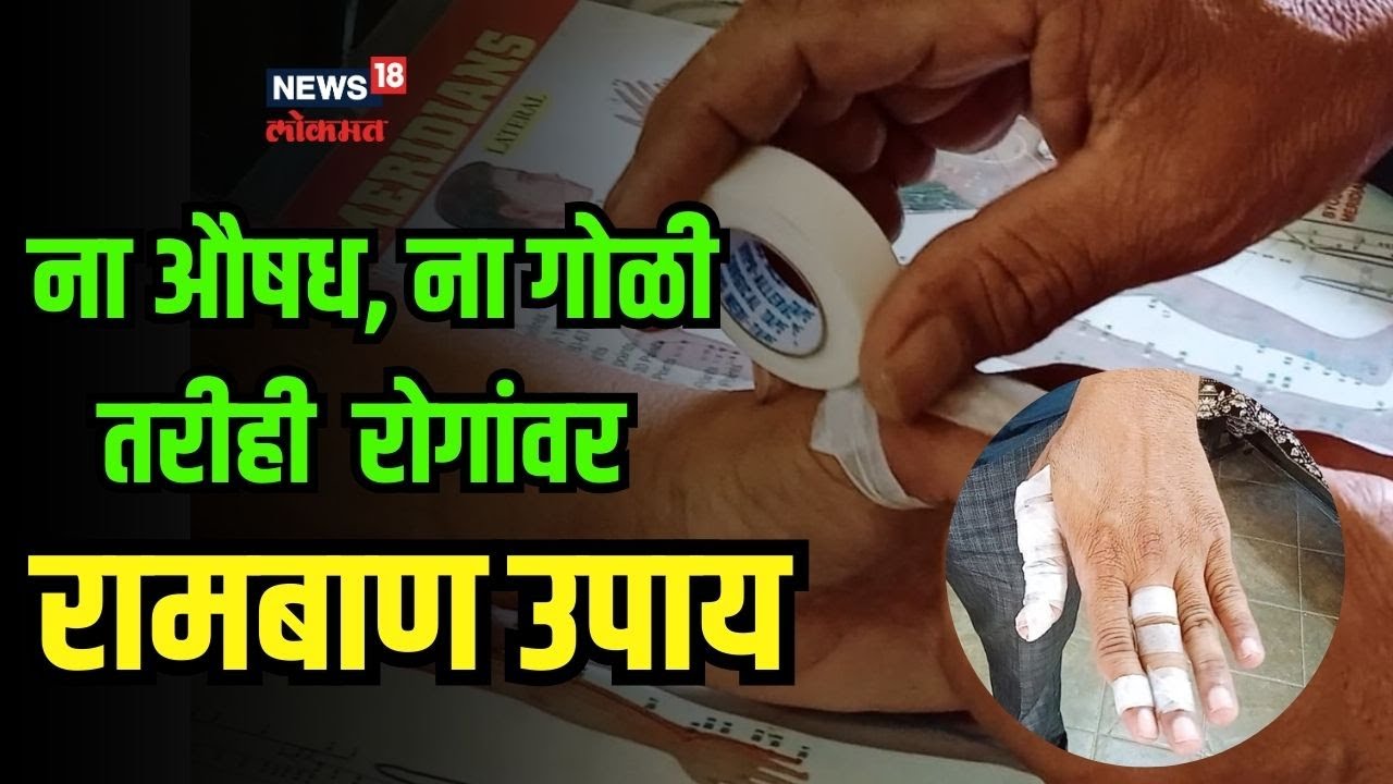 Sujok Therapy। ना औषध, ना गोळी, तरीही बरे होणार आजार, या गुणकारी ट्रीटमेंटबद्दल ऐकलंय का? #local18