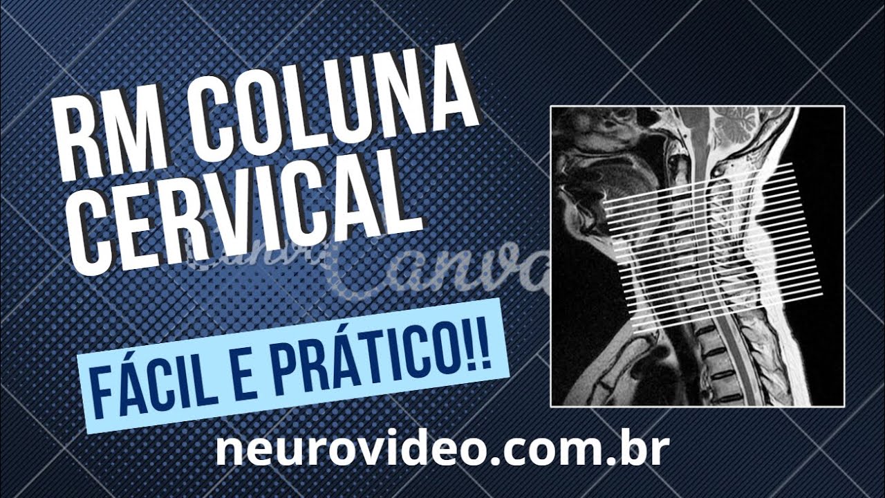 RM de Coluna Cervical