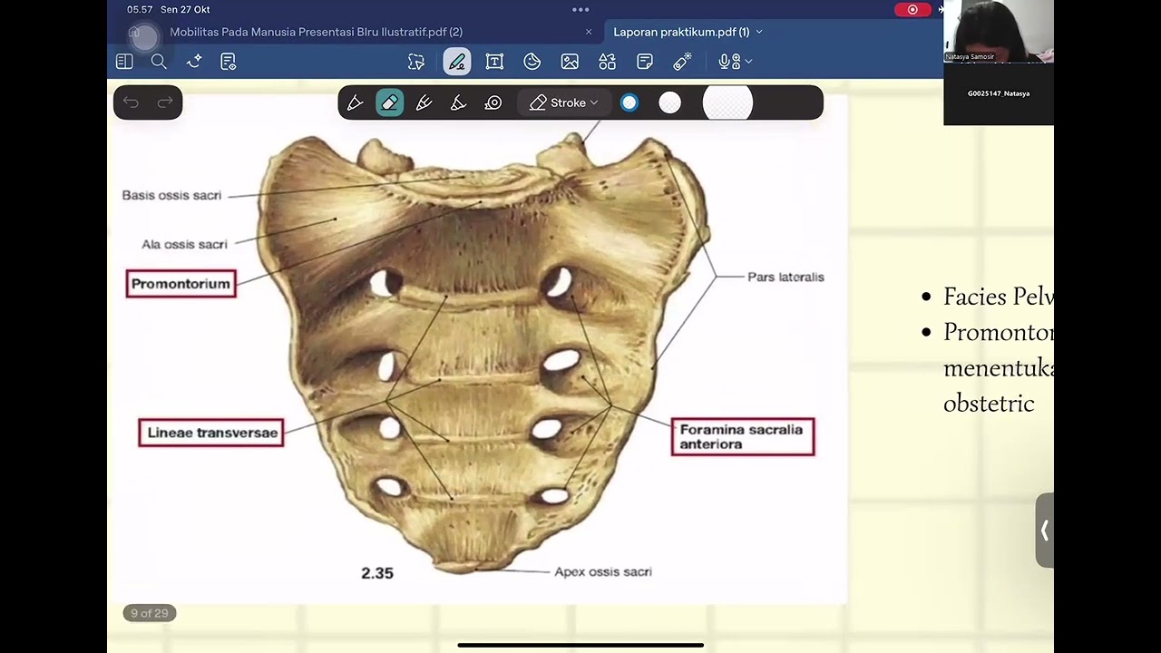 Anatomi Vertebrae, Plexus Brachialis, dan Regio Femoralis