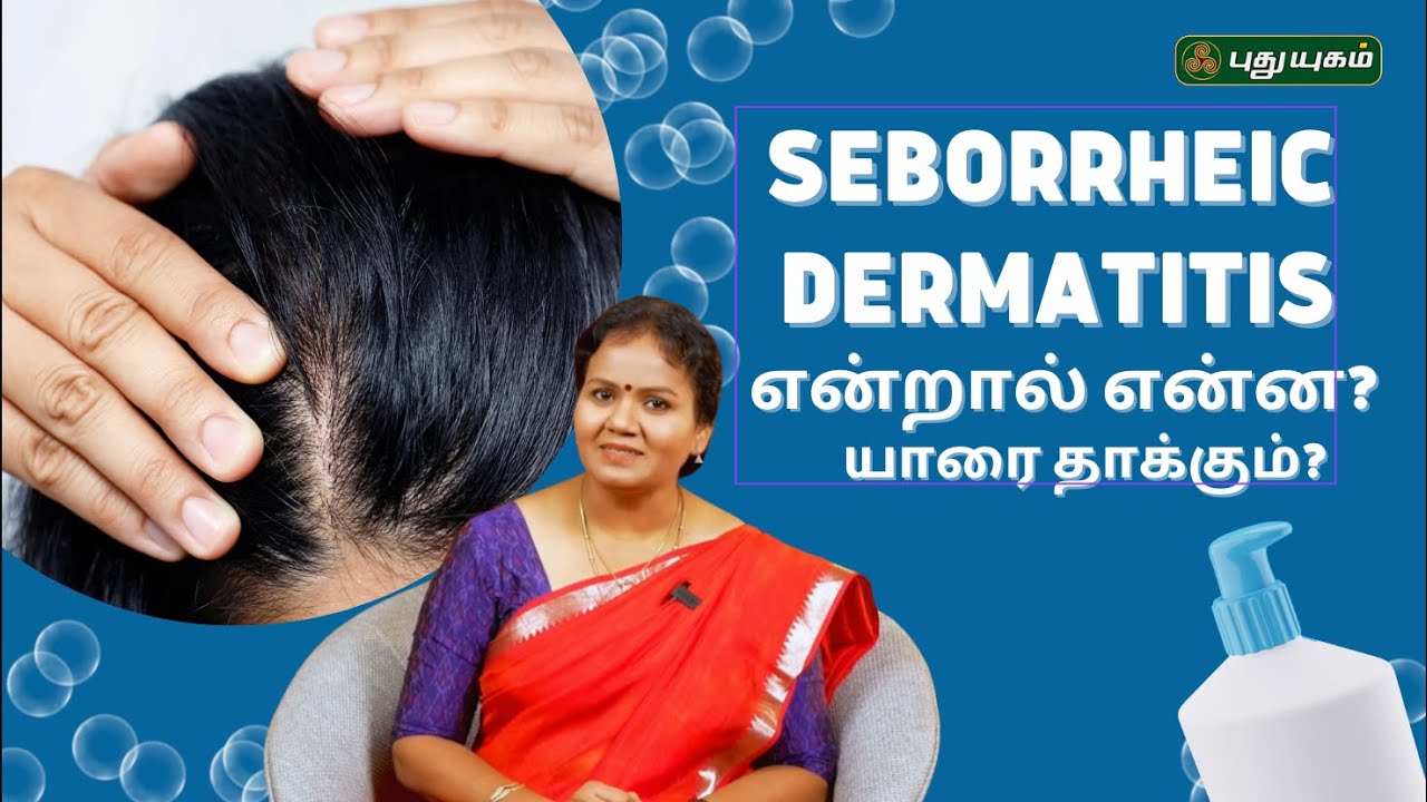 Seborrheic Dermatitis என்றால் என்ன? யாரை தாக்கும்? - Dr.Jayaroopa #yugamconnect #puthuyugamtv