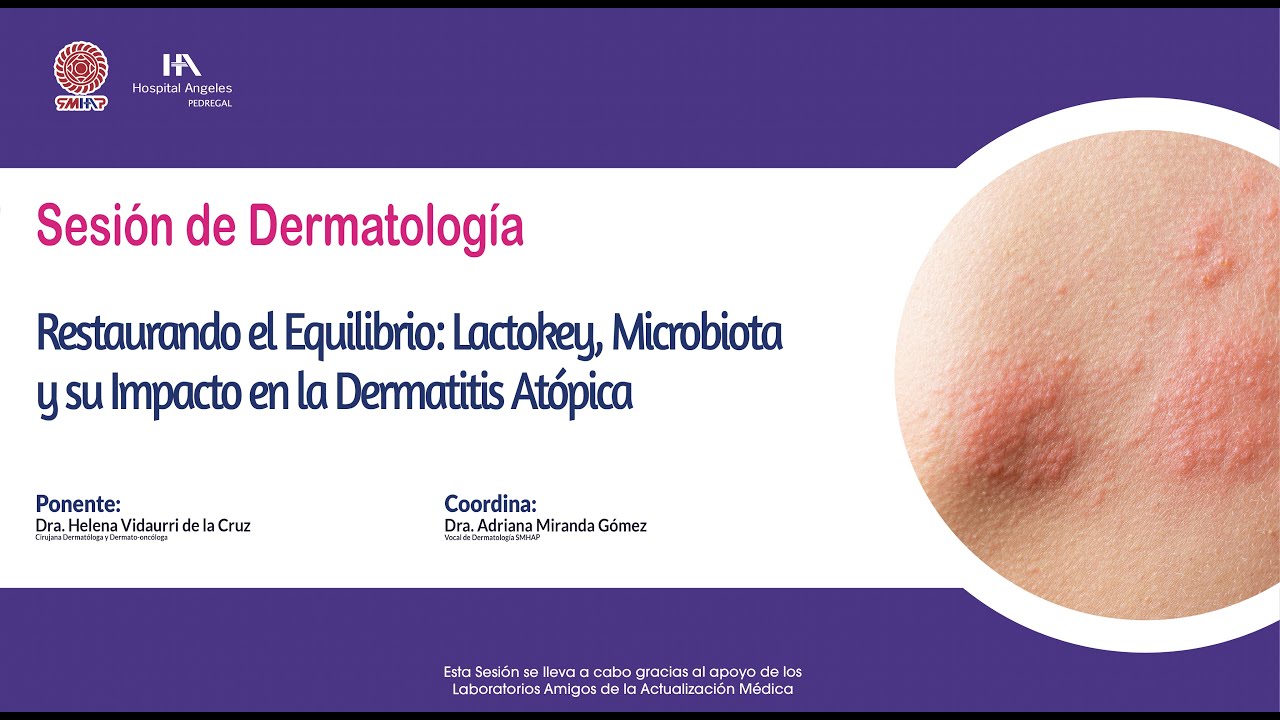 Restaurando el Equilibrio: Lactokey, Microbiota y su Impacto en la Dermatitis Atópica
