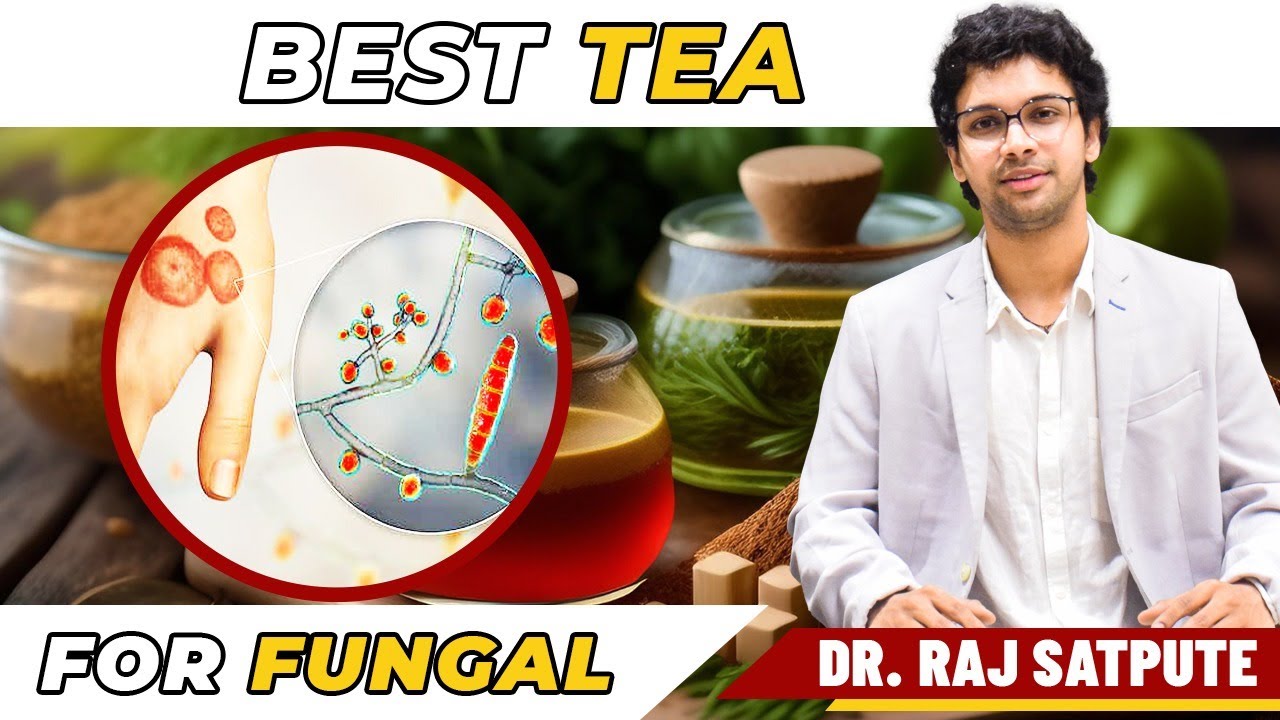 Best Tea To Cure Fungal Skin | How to Cure Fungal Infection Naturally & Permanently At Home