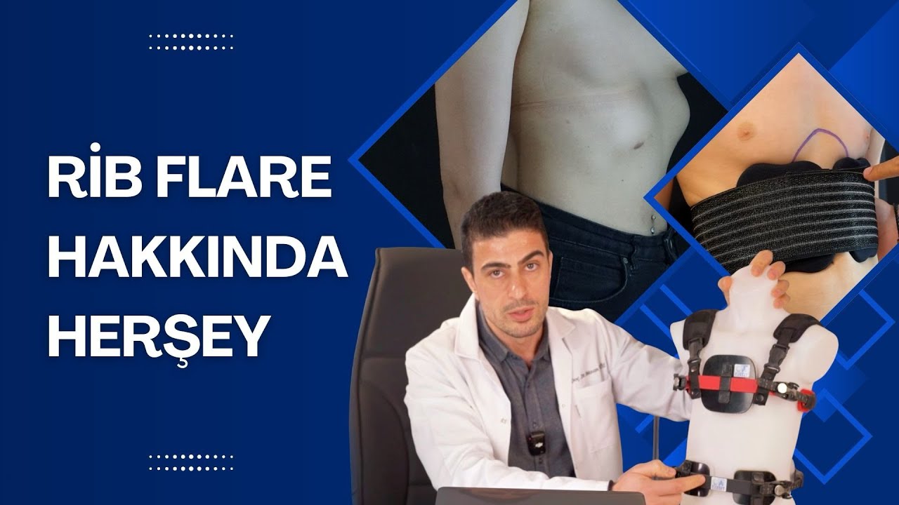 Rib Flare Hakkında Herşey