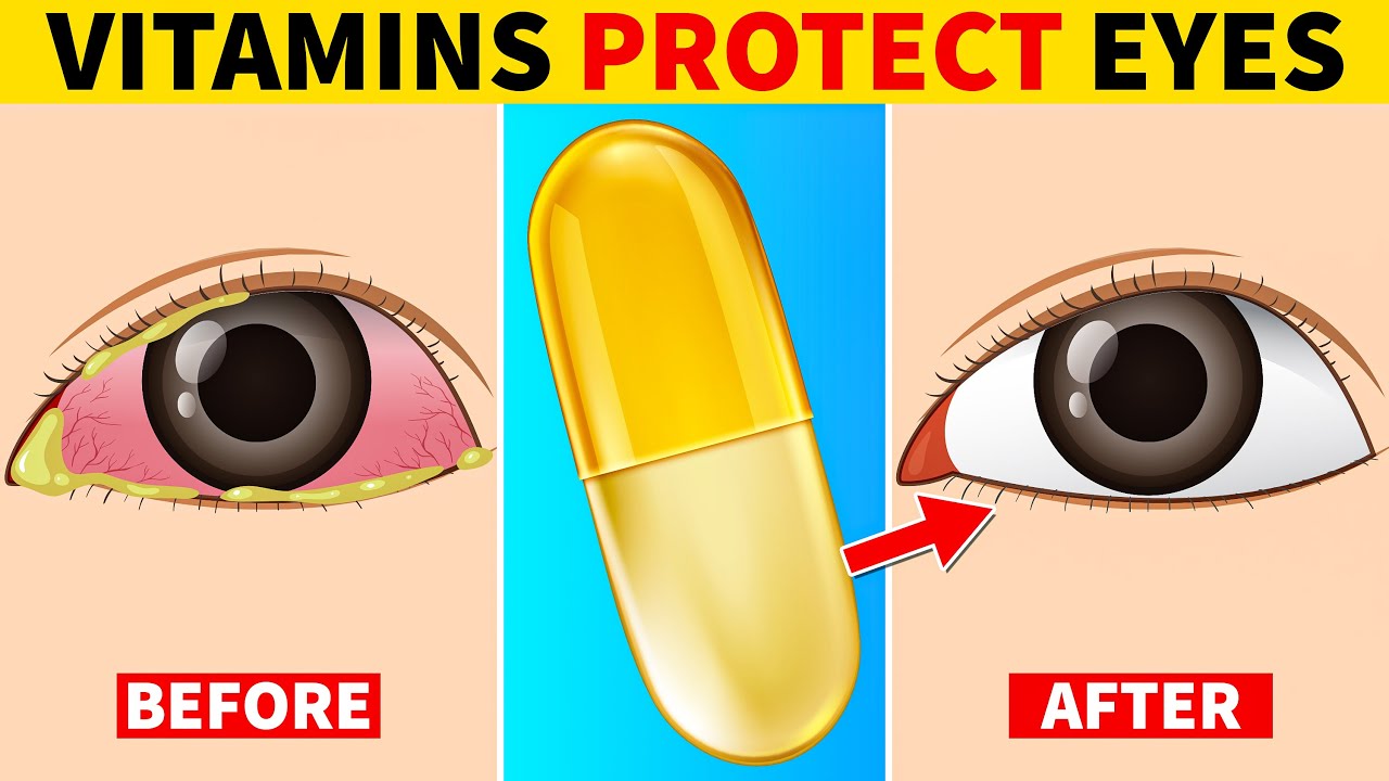 6 Vitamins That Protect Eyes and Repair Vision