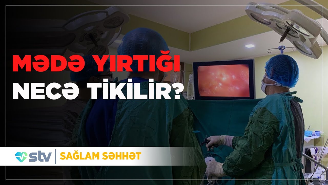 Mədə yırtığının tikilməsi - (16.12.2025)