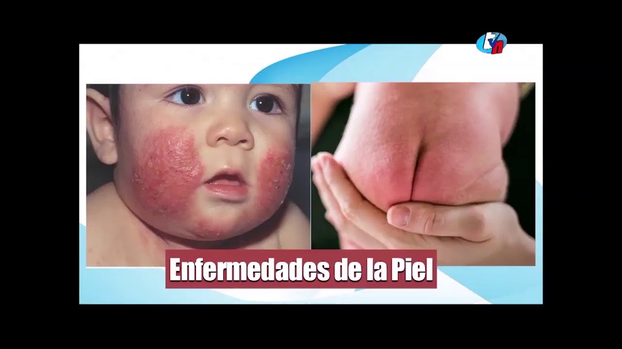 TVNORTE CAJAMARCA / PUNTOS DE VISTA 17/07/2020