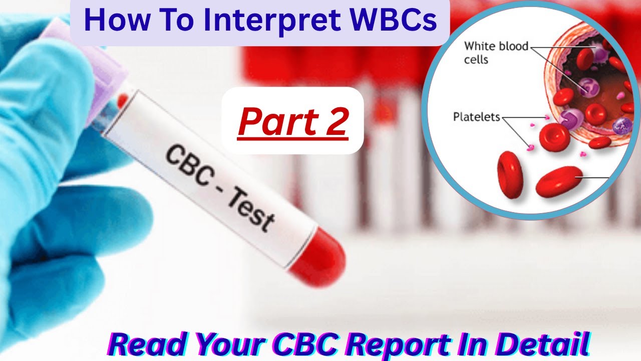 Why You Shouldn't Ignore Your WBC Count | CBC Explained|#cbc