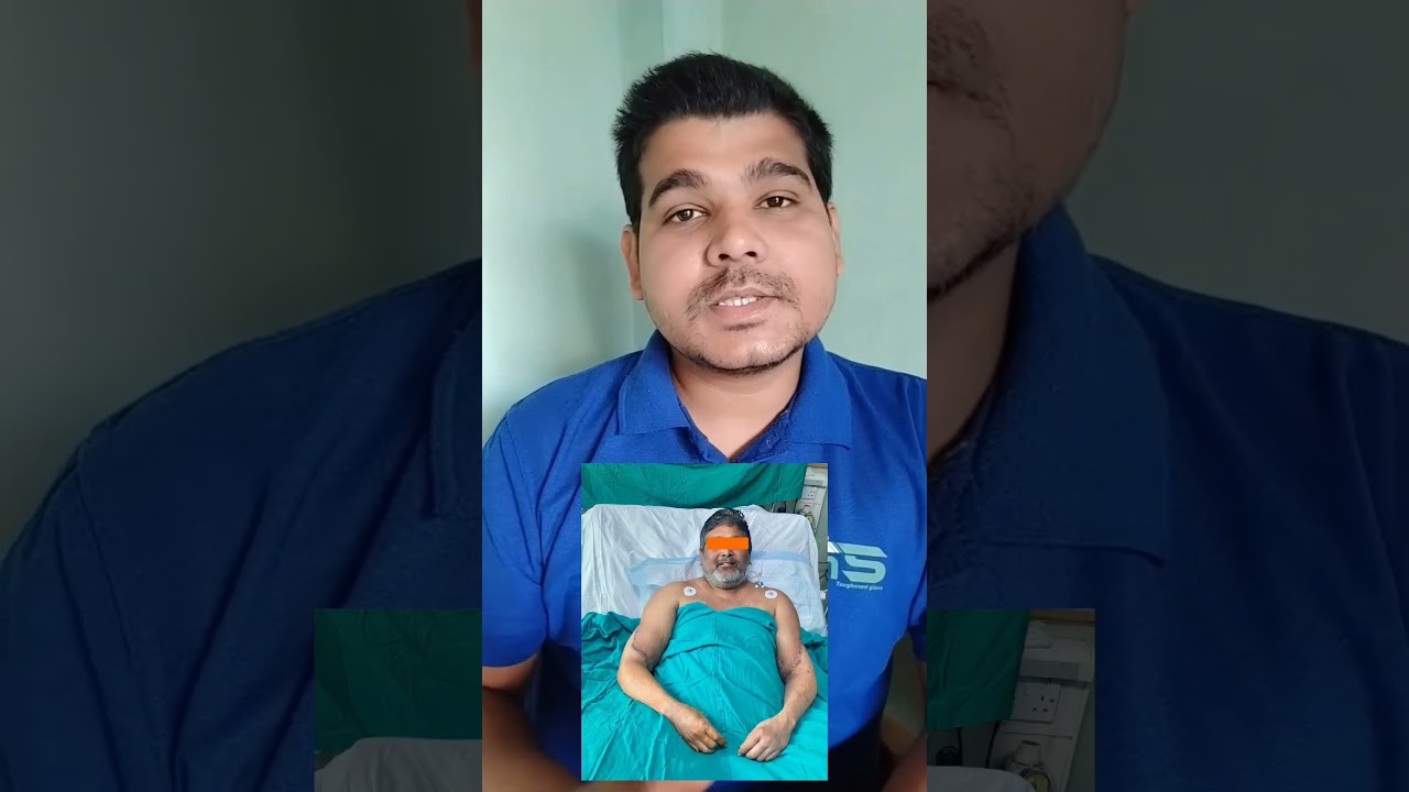 Sir Ganga Ram Hospital Hand transplant | #shorts