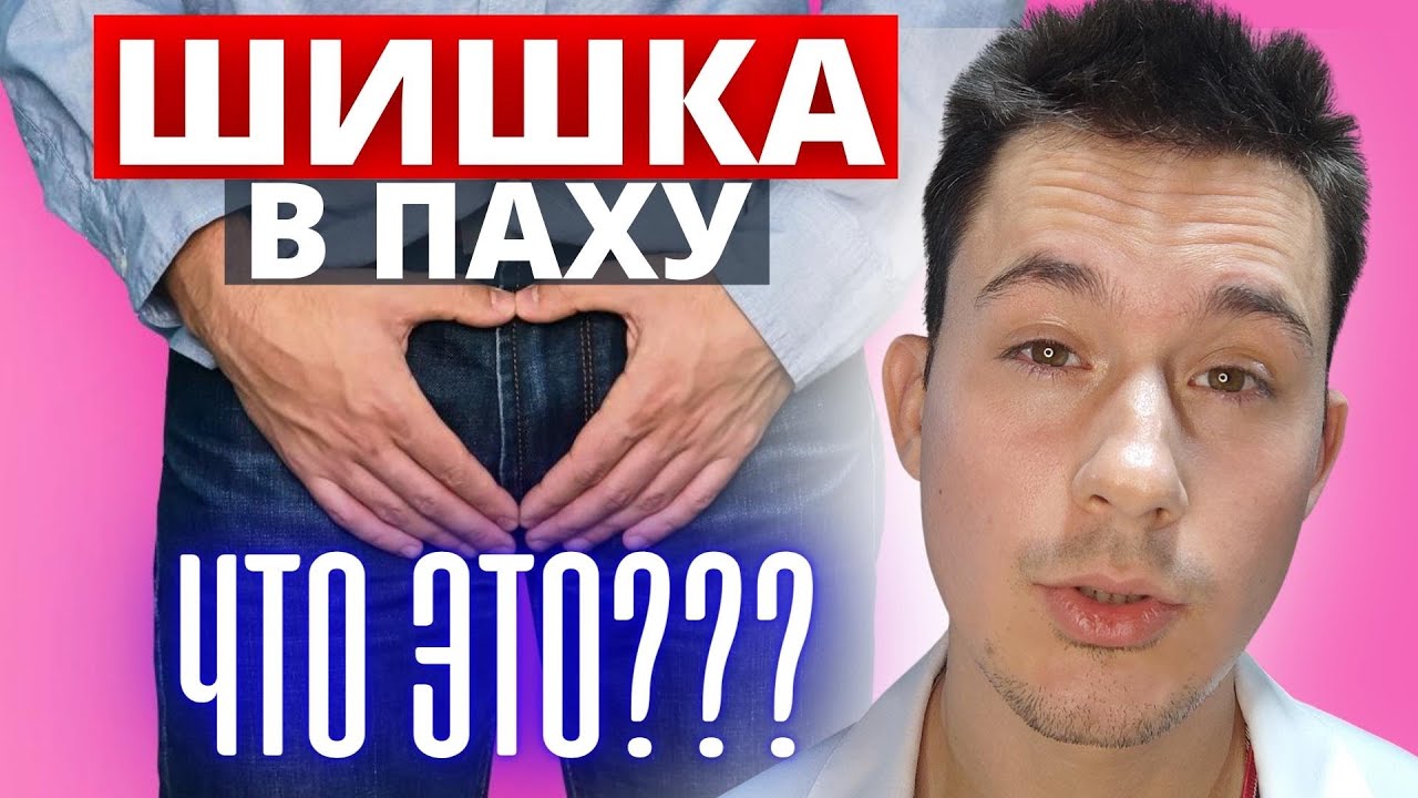Опухоль в паху: Паховая грыжа / лимфоузел в паховой области