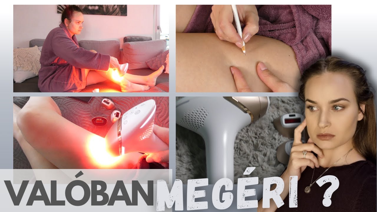 Működik?-Végleges szőrtelenítés otthon