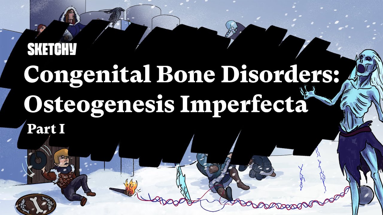 Congenital Bone Disorders: Osteogenesis Imperfecta (Part 1 of 2) | Sketchy Medical  | USMLE Step 1