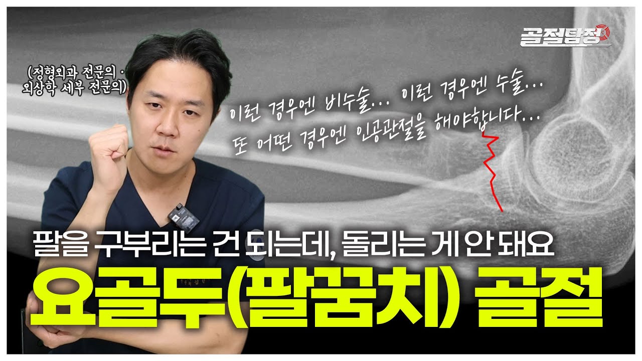 팔꿈치를 다친 후 구부리는 건 되는데 돌리는 게 안 돼요!｜요골머리 골절 비수술부터 수술까지