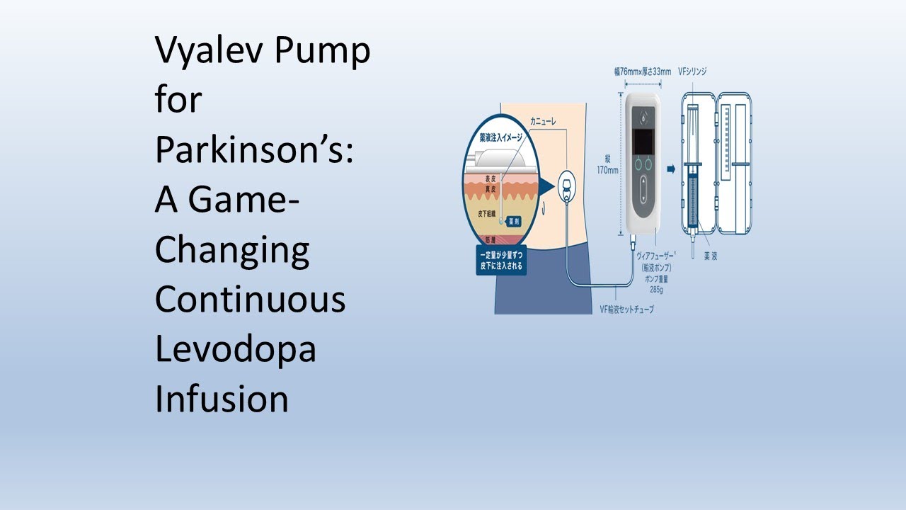 Parkinson’s Breakthrough: How the Vyalev Pump Is Changing Lives
