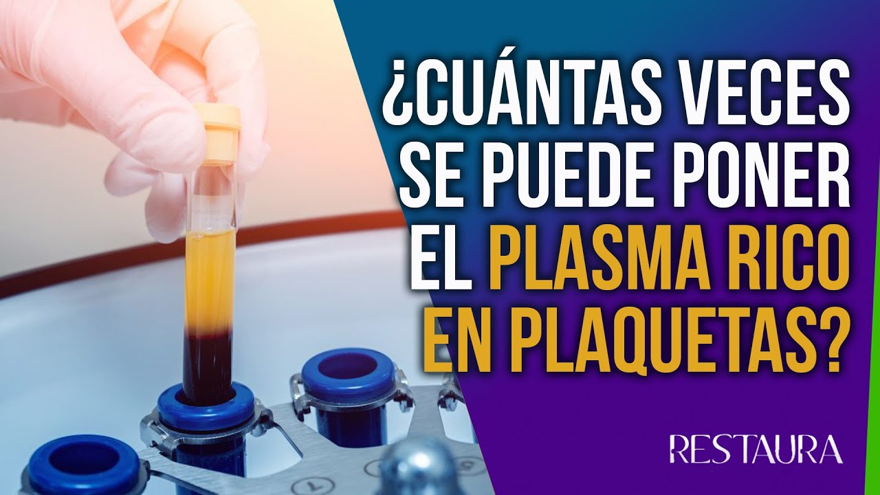 ¿Cuántas veces se puede poner el Plasma Rico en Plaquetas PRP?