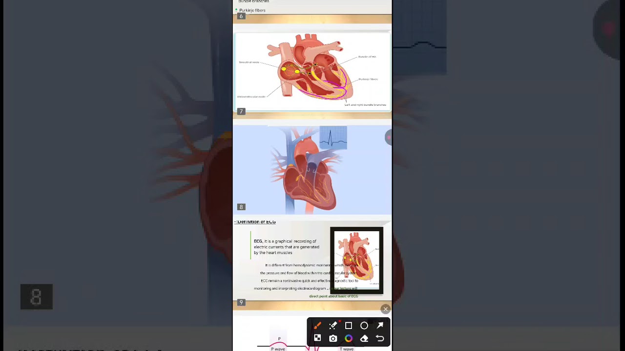 شرح ال ECG